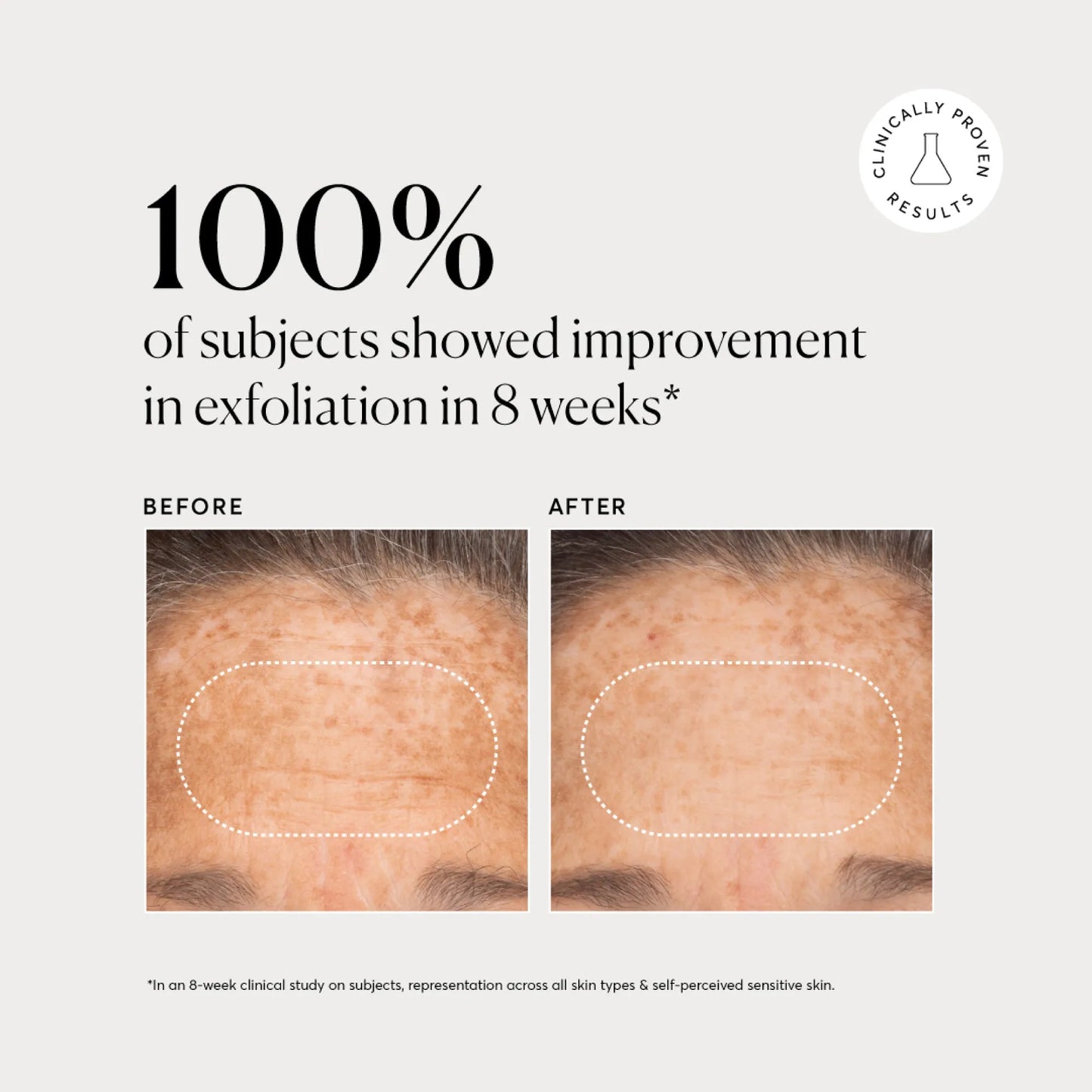 bha-liquid-exfoliant-2-v5 NATR-10027-Alt-Images-BHA-Liquid-Exfoliant-2_-03.webp
